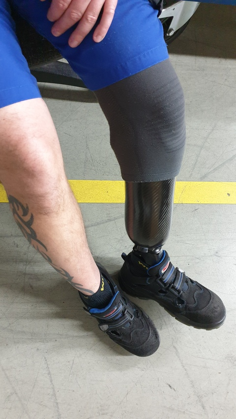 OnlyFans header picture amputee_leg39